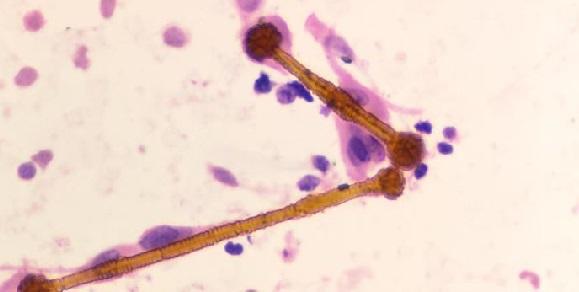 amianto al microscopio